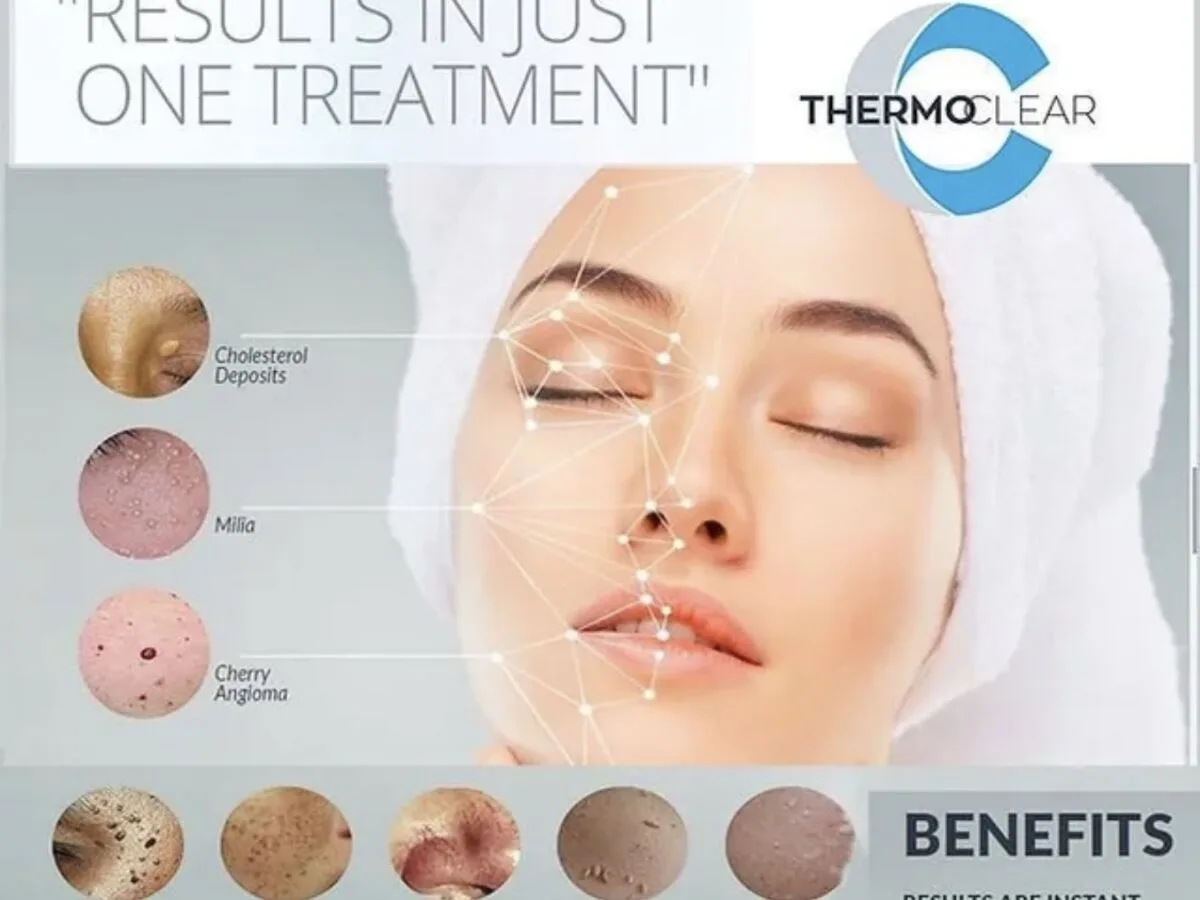 Superficial Skin Imperfections